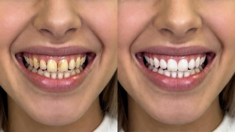 Как отбелить зубы дома за неделю — 7 рабочих способов, которые реально работают (Обзор 2026)